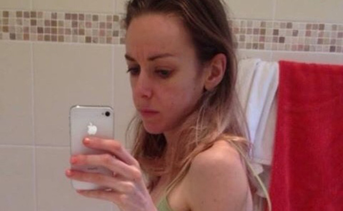 La anorexia la dejó en 37 kilos: Ahora es concursante fitness de bikini