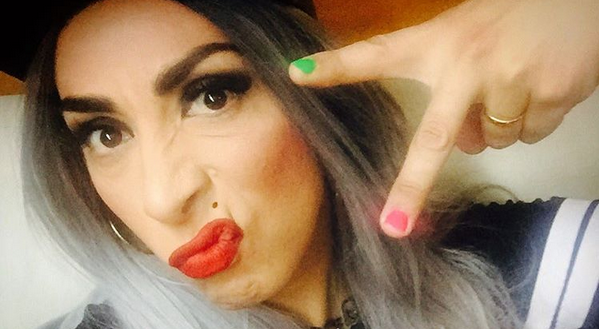 Botota Fox sorprende a sus fans en 