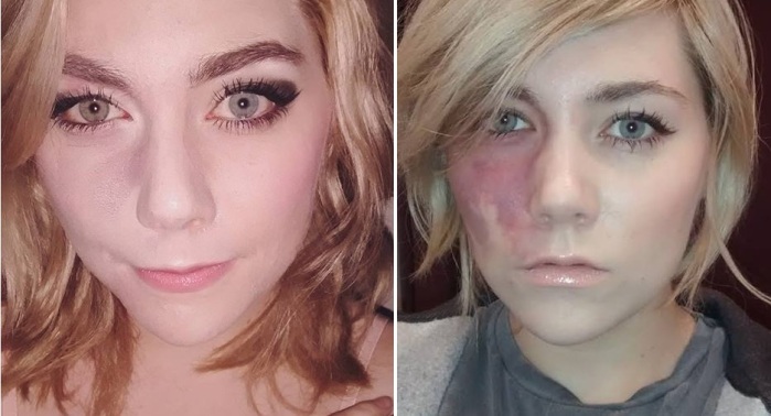 Le tapó la boca a quienes le dijeron 