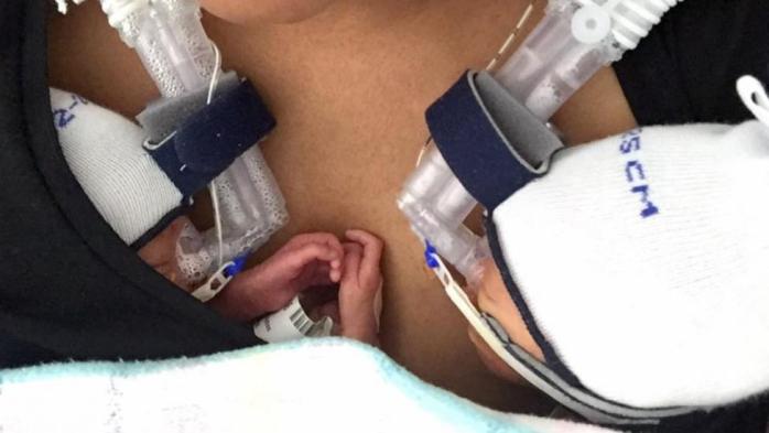 El sorprendente video de unos gemelos recién nacidos que  conmueve a las  redes sociales