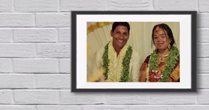 Se casó con la mujer que amaba aunque un accidente deformó su rostro: Hoy son padres