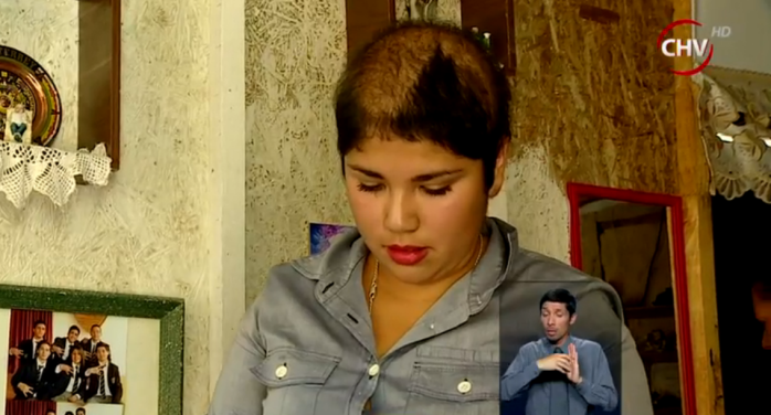 Joven practicante perdió su pelo: Quedó atrapada en máquina de taller de autos