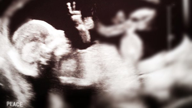 Ecografía | CBS Boston