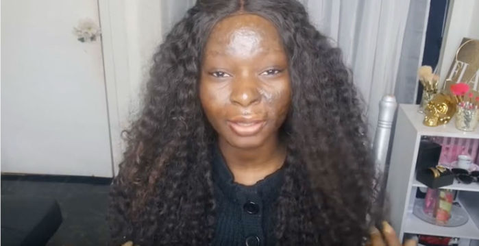 Joven que sobrevivió a un incendio transforma su rostro con maquillaje y es increíble