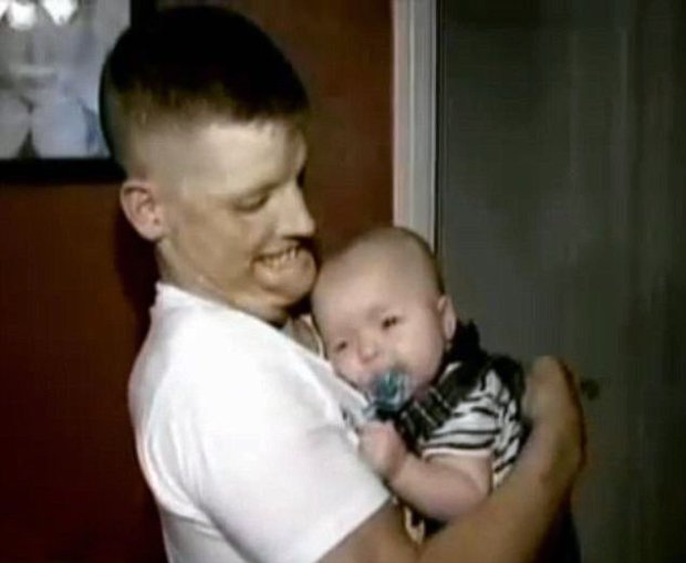 Quedó con el rostro desfigurado tras accidente: Así se recupera hoy luego de un trasplante