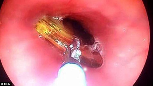 2FD5A56500000578-3386631-image-a-47_1452075820604