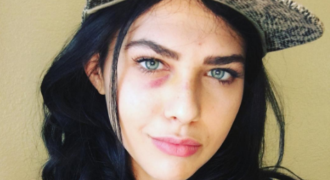 Modelo es atacada por un descontrolado dron en sesión de fotos