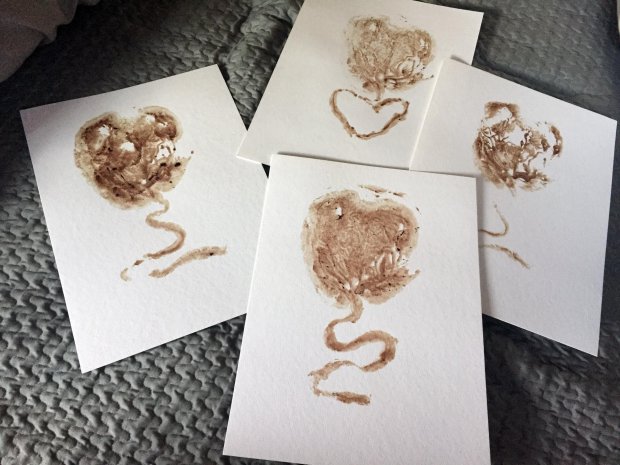 Impresiones de placenta | Metro.co.uk