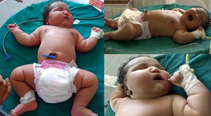 Sorprendente: 6,8 kilos pesó la bebé más 'grande' jamás nacida