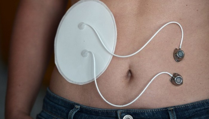 Novedoso invento podría cambiar la vida de miles de diabéticos