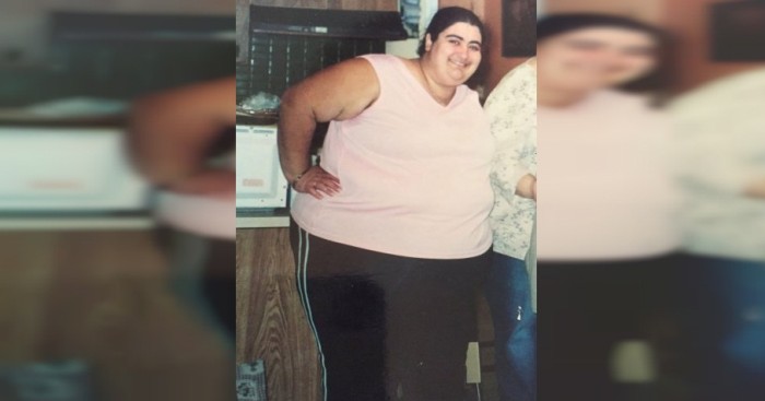 Joven sobrevivió a accidente gracias a sus 215 kilos: Hoy sólo pesa 70
