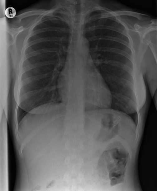 Barcroft | The Telegraph