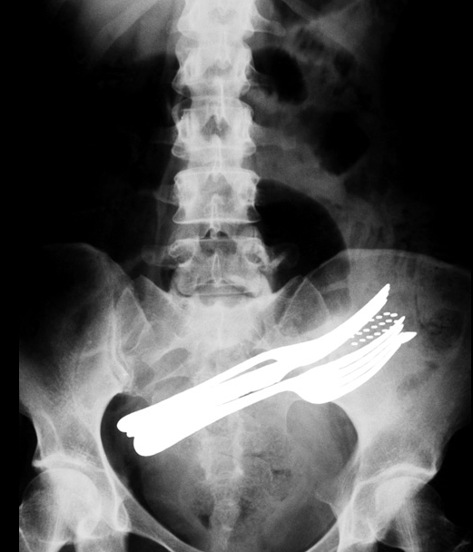 Barcroft | The Telegraph