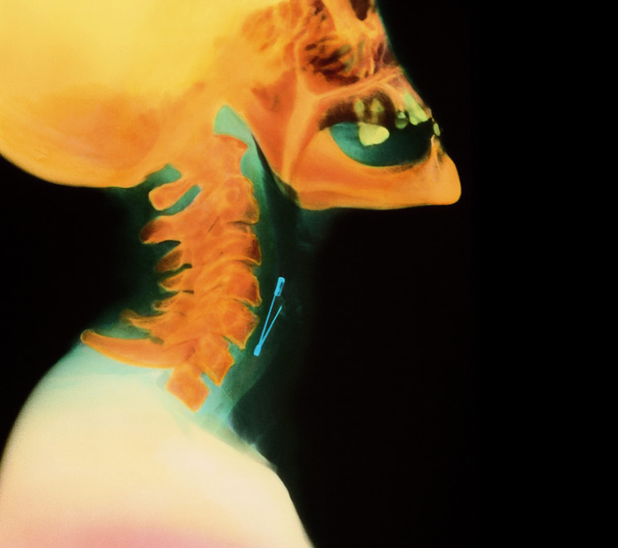 ¡No creerás lo que ves! Los 10 rayos X más insólitos del mundo