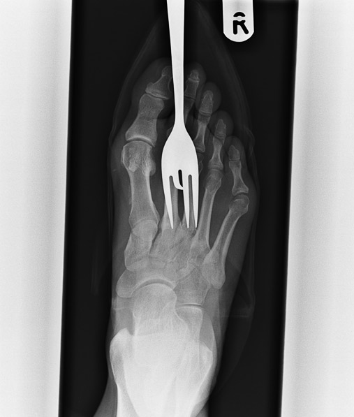 Barcroft | The Telegraph