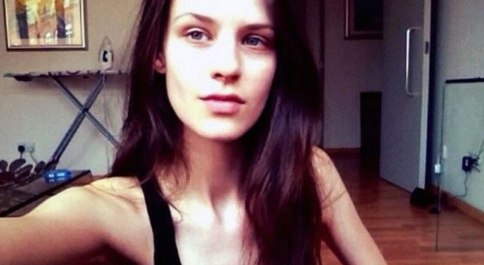 Exmodelo culpa a la industria por su adicción a las drogas y trastorno alimentario