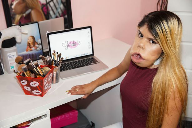 Mariamar Quiora: la joven con un gran tumor facial que inspira a millones en Youtube