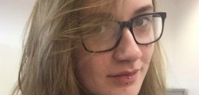 Estudiante quedó calva: estrés y exámenes de la universidad fueron los culpables