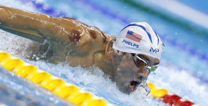 El curioso motivo por el que Michael Phelps tiene manchas oscuras en su espalda