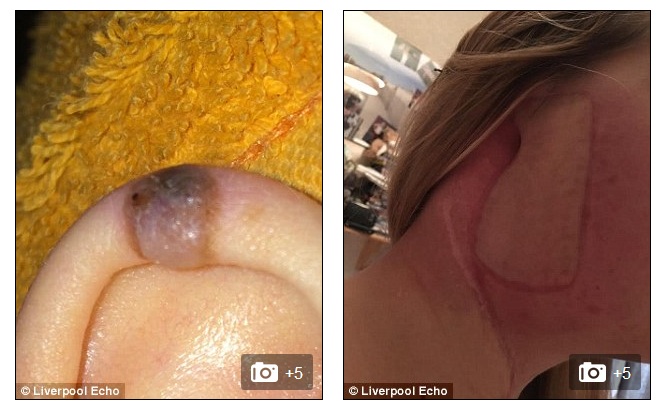 Foto | Liverpool Echo 