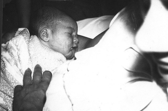 Bebé nació con 15 dedos en la mano y 16 en el pie: deberá someterse a una cirugía