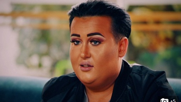 Joven adicto al relleno de labios sufrió una terrible consecuencia: le explotaron