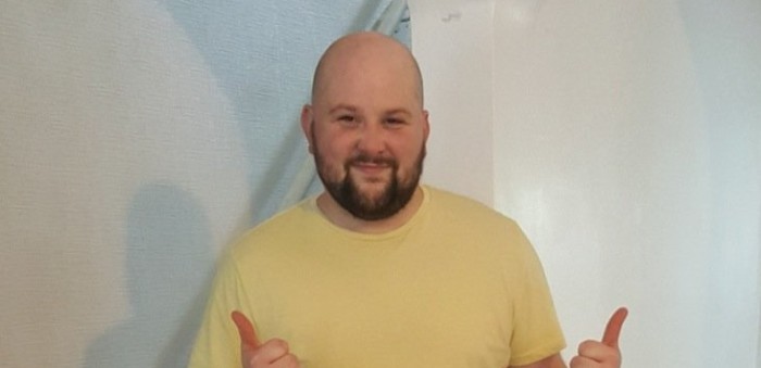 Hombre que sufrió la amputación de una pierna por diabetes encontró una original solución