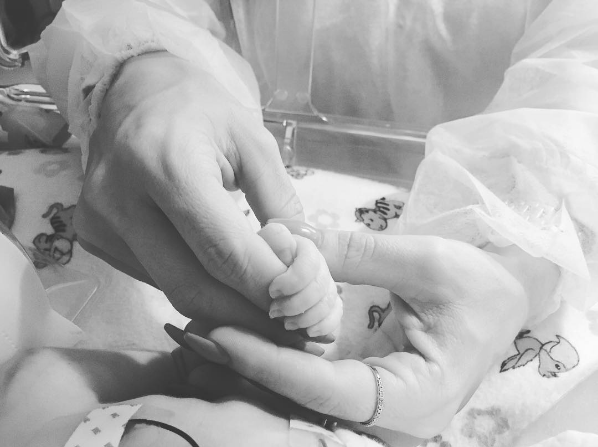 ¿Qué es el Síndrome de Patau? La enfermedad que acabó con la vida de la hija de Wisin