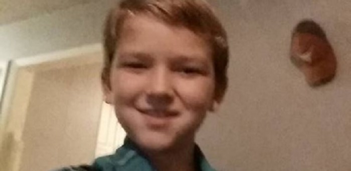 Niño se debate entre la vida y la muerte tras brutal ataque: tiene 20% del cuerpo quemado