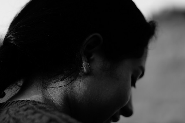 Joven asegura que su cara no luce igual tras sufrir grave accidente en motocicleta