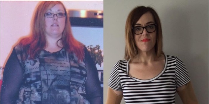 Pesaba 178 kilos por una incontrolable obsesión a los chocolates: los dejó y bajó 95