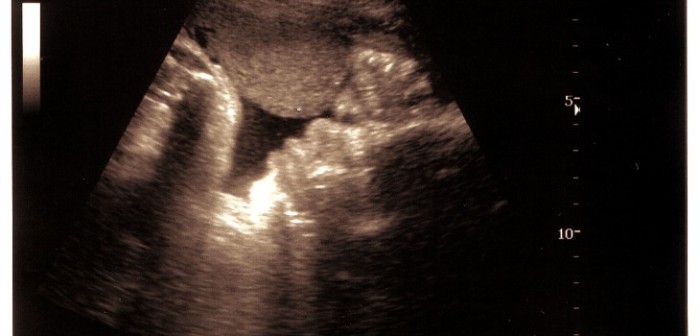 Desubicado comentario descolocó a orgullosa madre tras compartir la ecografía de su hija