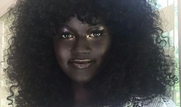 Sufrió bullying por su color de piel: hoy es una modelo que lucha por la diversidad