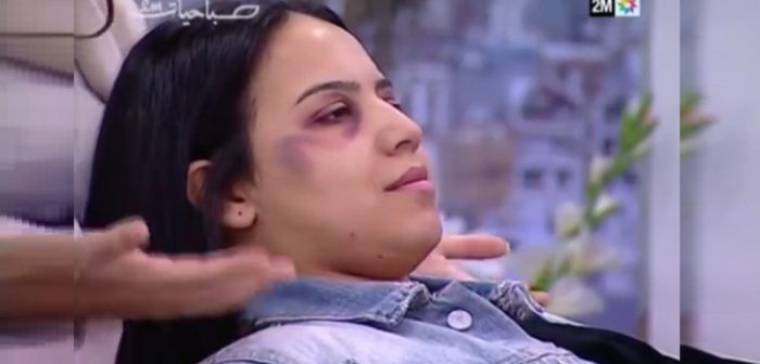 Indignación causa tutorial de maquillaje para ocultar rastros de violencia intrafamiliar