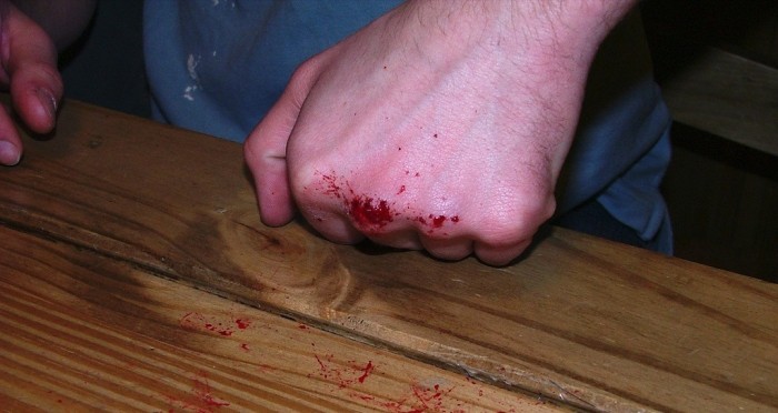 Inglaterra: Hombre desnudó a su pareja, la arrastró por el piso y le hizo tragar pegamento