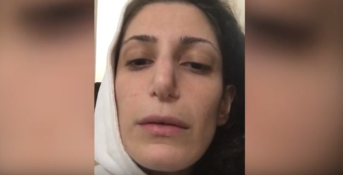 Video muestra los estragos de una cirugía de nariz mal hecha: joven no puede respirar