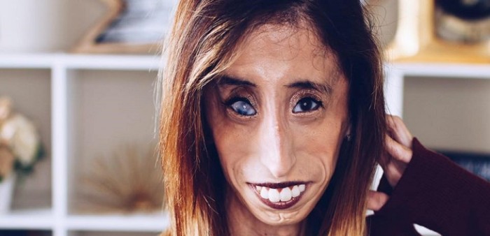 Mujer protagonista de cruel meme rompe el silencio: pide un poco de consideración