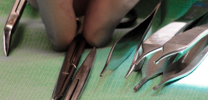 Hombre vivió 18 años con tijeras alojadas en su estómago: medían 15 centímetros