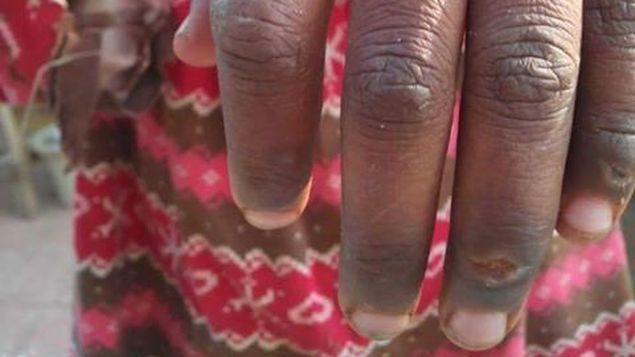 Una niña de 10 años que trabajaba como 'criada' para un juez fue torturada en Pakistán