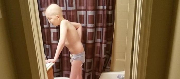 Mamá comparte desgarradora imagen de su hijo con leucemia y entrega poderoso mensaje