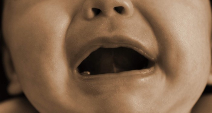 Padre australiano bañó en gasolina a su hija y le prendió fuego por ser 'muy bonita'