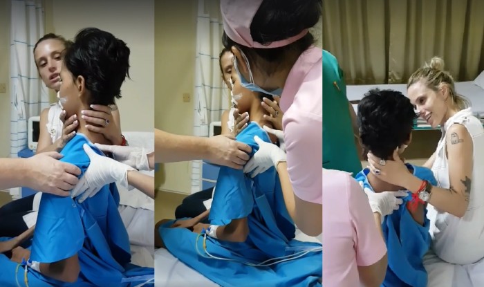 El extraño caso de la joven camboyana que perdió la mitad del rostro por dura enfermedad