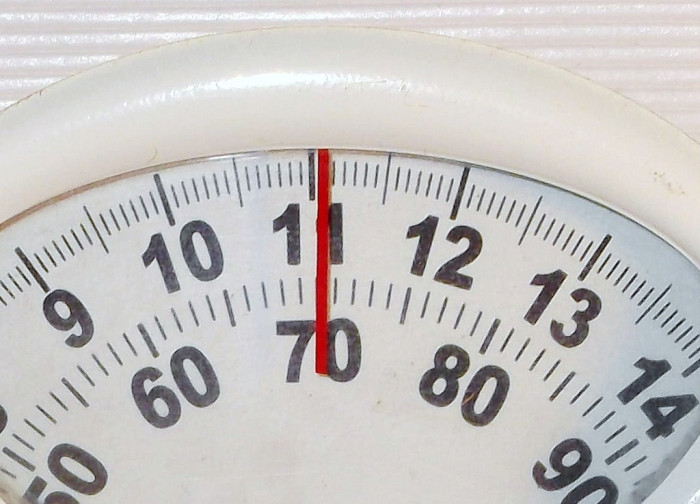 La mujer más obesa del mundo pierde 100 kilos tras exitosa operación en India