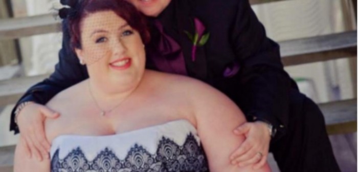 Impactante antes y después en el rostro de una joven que bajó 77 kilos: es otra persona