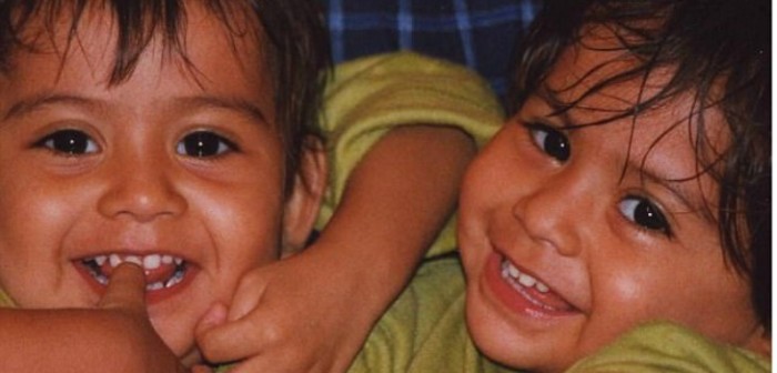 Lupita y Carmen: así lucen las siamesas más famosas del mundo a sus 16 años