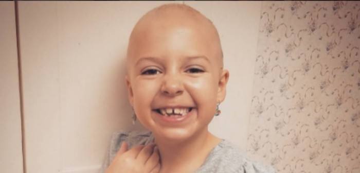 Pequeña con alopecia innovó con peculiar y bello 'peinado' que encantó a compañeros