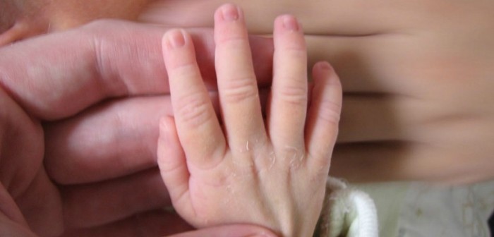 Bebé llamó la atención tras nacer con condición que le dejó el pelo blanco