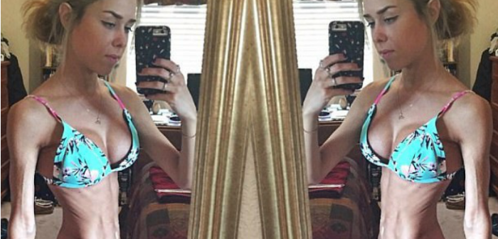 Joven luce su saludable cuerpo tras casi perder la vida por un desorden de alimentación
