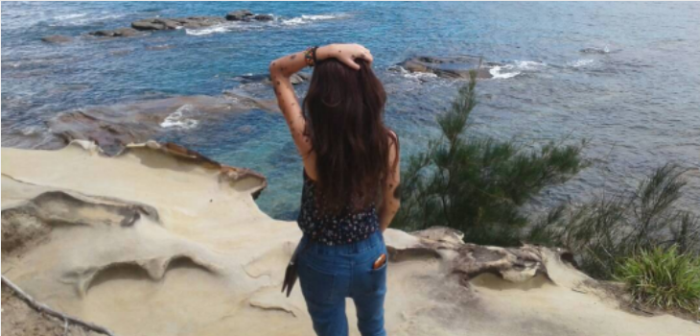 Joven con manchas de nacimiento dejó atrás sus inseguridades: quiere ser Miss Universo