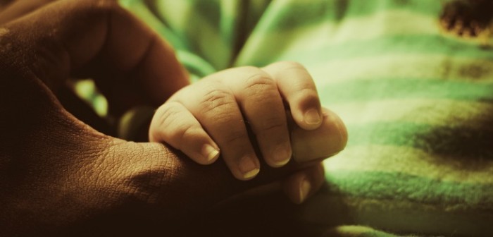 Niño que nació sin nariz murió a sus dos años tras una dura batalla para mantenerse vivo